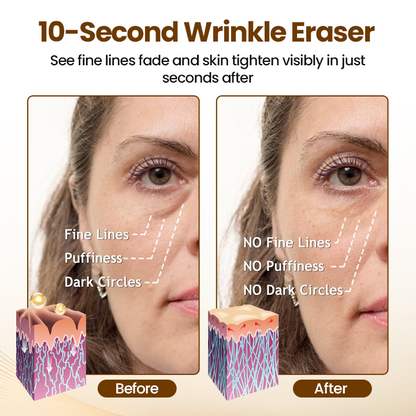 10s Wrinkle——Smooth,Serum Works Fast