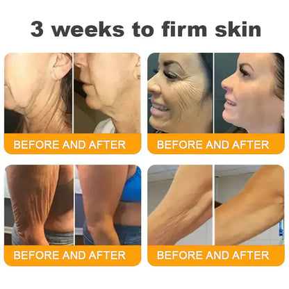 𝐋𝐎𝐕𝐈𝐋𝐃𝐒™ 𝐁𝐞𝐞 𝐕𝐞𝐧𝐨𝐦 𝐀𝐥𝐥-𝐢𝐧-𝐎𝐧𝐞 𝐂𝐫𝐞𝐚𝐦–🌸 Anti-aging,Hydrating, Skin Repair, Even Tone, Acne and Dark Spot Treatment, Wart and Mole Removal, Psoriasis Relief