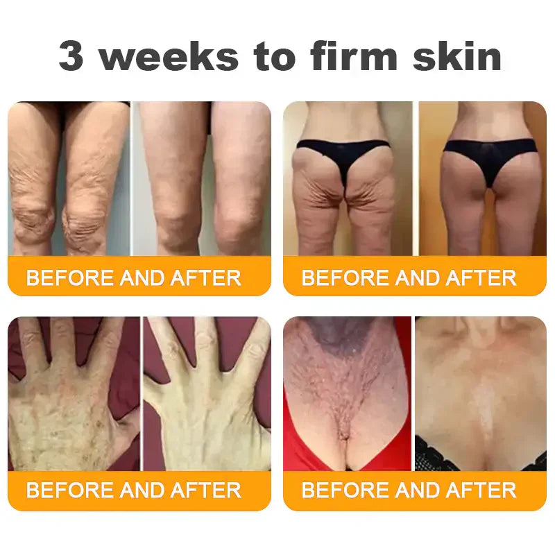 𝐋𝐎𝐕𝐈𝐋𝐃𝐒™ 𝐁𝐞𝐞 𝐕𝐞𝐧𝐨𝐦 𝐀𝐥𝐥-𝐢𝐧-𝐎𝐧𝐞 𝐂𝐫𝐞𝐚𝐦–🌸 Anti-aging,Hydrating, Skin Repair, Even Tone, Acne and Dark Spot Treatment, Wart and Mole Removal, Psoriasis Relief