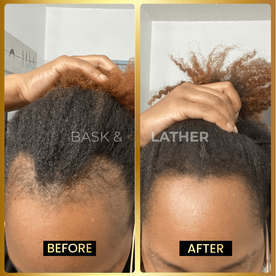 Final 3 hours-60%OFF＆Awaken Your Scalp