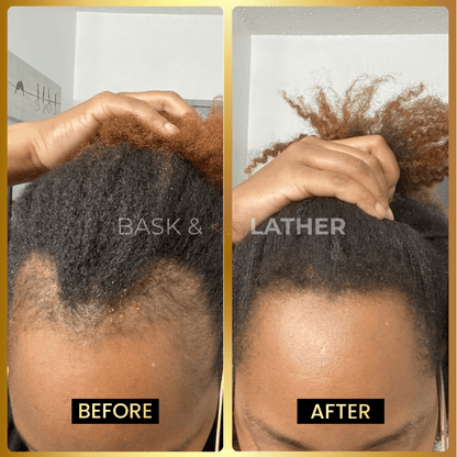 Final 3 hours-60%OFF＆Awaken Your Scalp