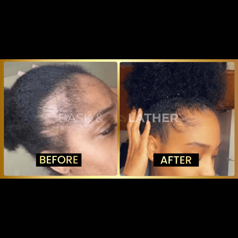 Final 3 hours-60%OFF＆Awaken Your Scalp