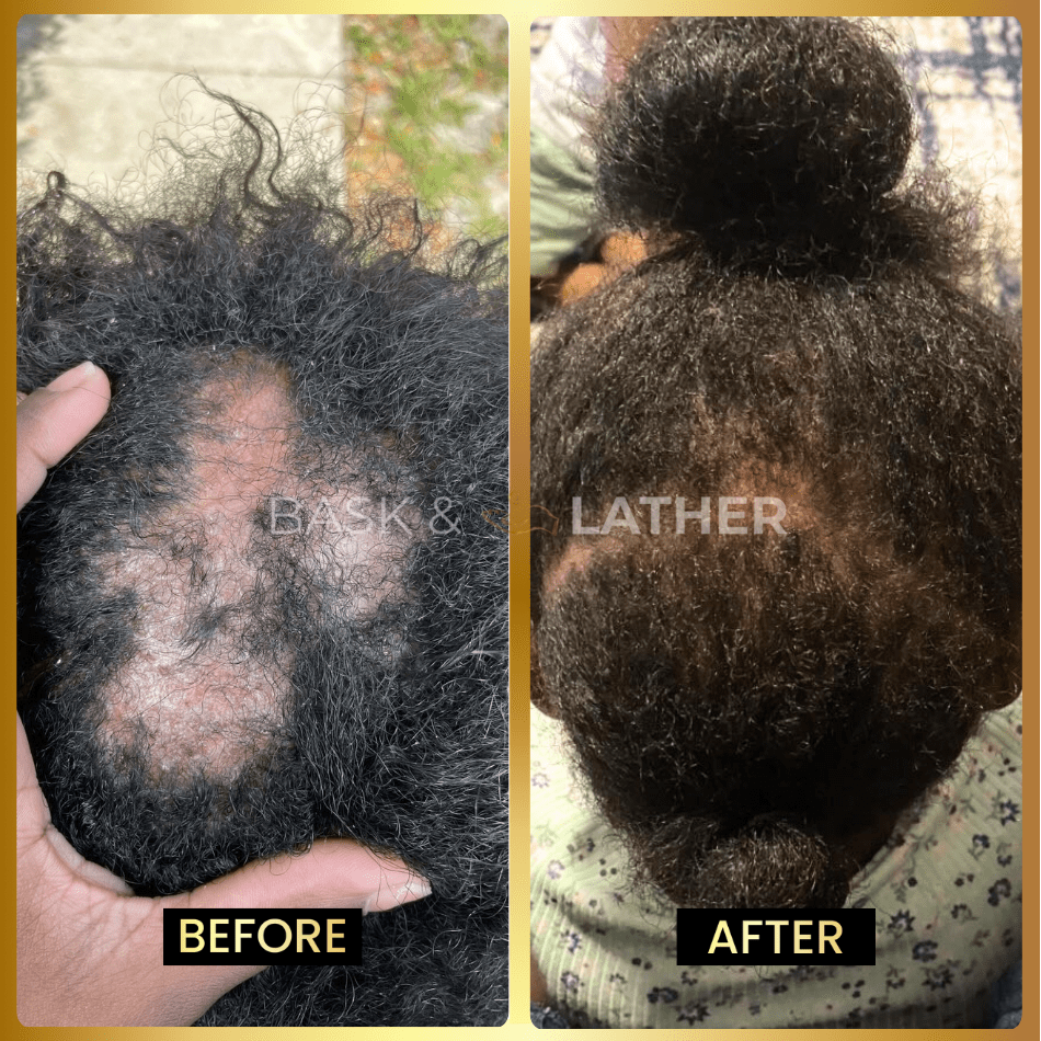 Final 3 hours-60%OFF＆Awaken Your Scalp