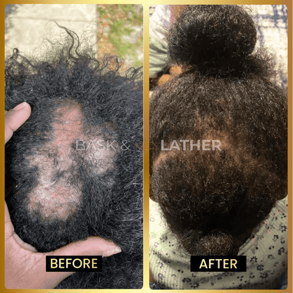 Final 3 hours-60%OFF＆Awaken Your Scalp