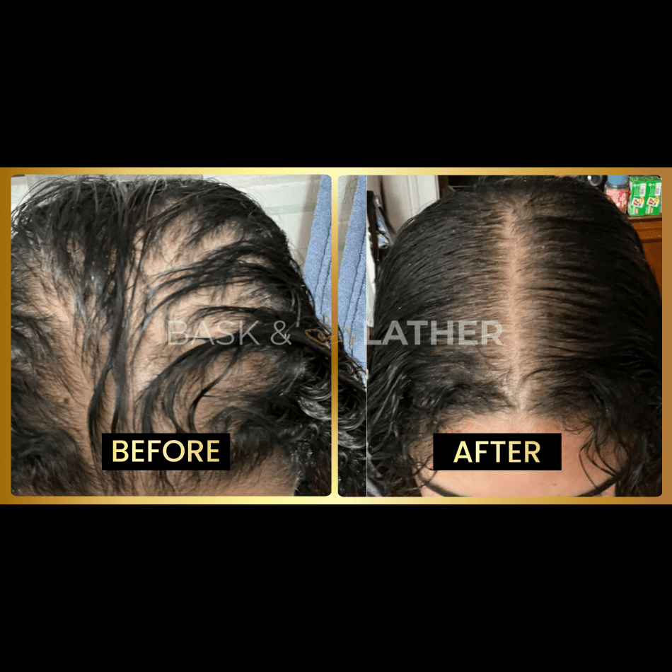 Final 3 hours-60%OFF＆Awaken Your Scalp