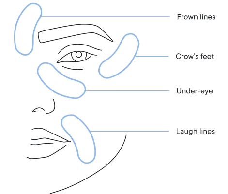 🔥Final 3 hours-60%OFF &Smooth, firm and plump stubborn areas with Micro-Infusion Targeted Patches