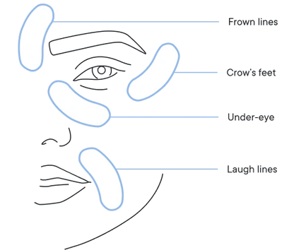 🔥Final 3 hours-60%OFF &Smooth, firm and plump stubborn areas with Micro-Infusion Targeted Patches